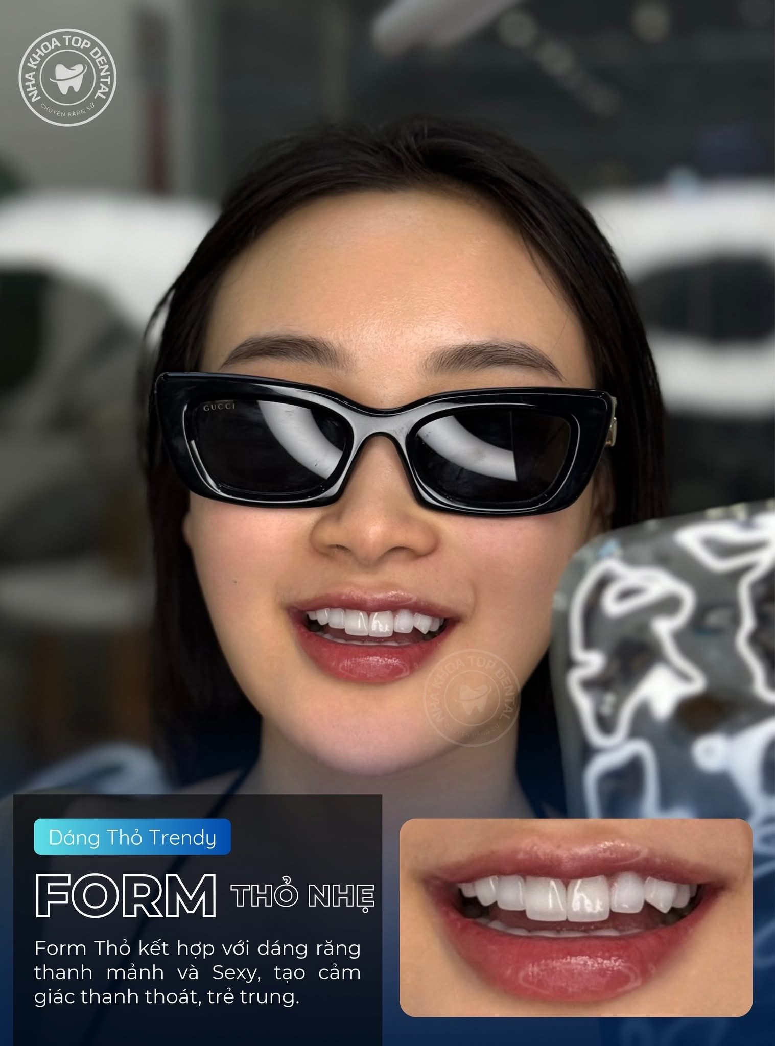 20 Răng Zirconia