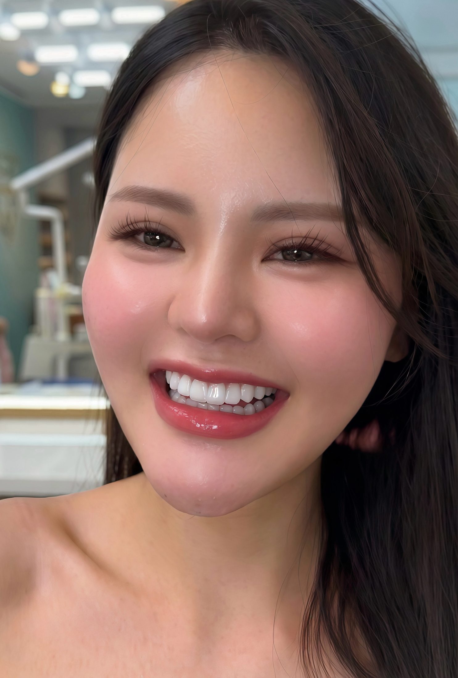 20 Răng Zirconia